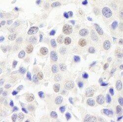 ABC2 Antibody, Novus Biologicals 0.1mg; Unlabeled:Antibodies, Polyclonal